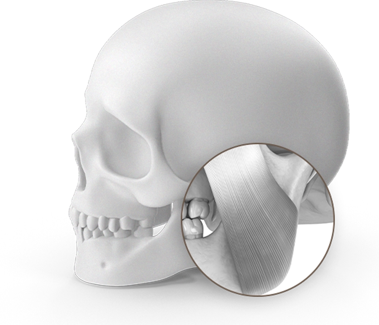 Эрүүний булчингийн байршлыг харуулсан хүний гавлын ясны хажуугийн дүрслэл, эрүүгийн шугам лифтинг мэс заслын зураг.