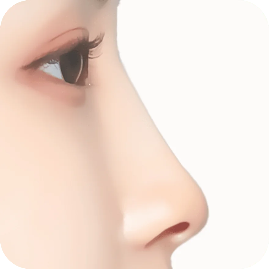 Хажуугийн харагдах байдлаар хамар, нүдний хэсгийн нүүрний контур, лифтинг мэс заслын зургийг харуулсан зураг.