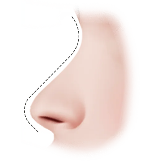 Нүүрний хажуугийн хэсгийн зураг, нүүрний контур, лифтинг мэс заслын үр дүнгийн зураг.