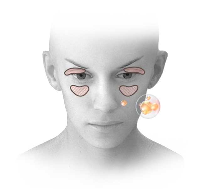 Нүүрний контур, лифтинг мэс заслын зурагт нүдний дээд болон доод хэсэгт, хацар дээр тодруулсан хэсгүүдийг харуулсан байна.