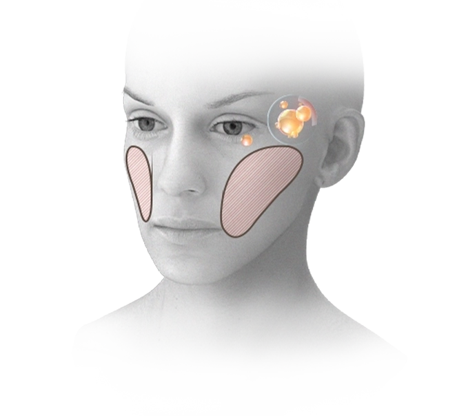 Эмэгтэй хүний нүүрний зураг дээр хацар болон нүдний доод хэсэгт нүүрний контур, лифтинг мэс заслын хэсгийг тэмдэглэсэн байна.