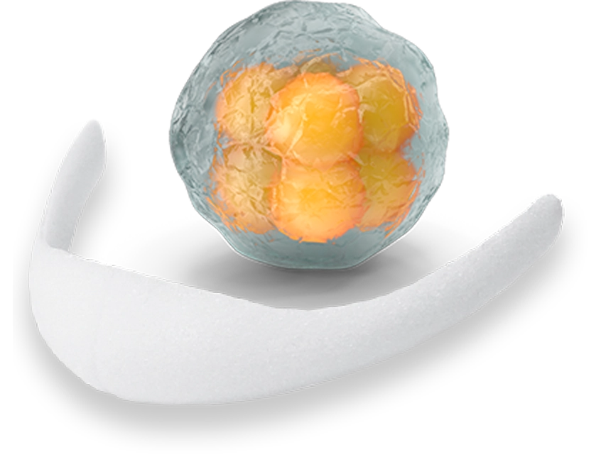 Эрүүний шугам лифтинг мэс заслын үед эрүүний хэлбэрийг сайжруулах зорилгоор суулгадаг силикон протезийн зураг.