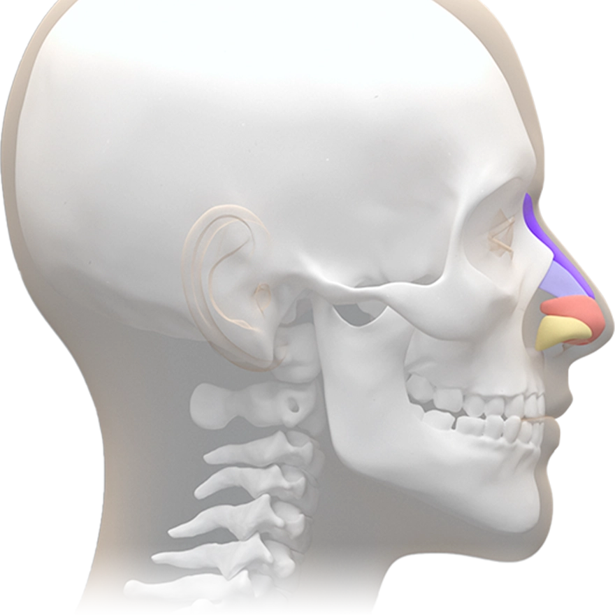 Хүний гавлын ясны хажуугийн дүрслэл дээр хамар заслын үеийн мөгөөрс болон ясны хэсгийг өнгөөр ялган харуулсан байна.