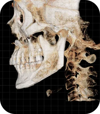 Энэ бол эрүүний шугам лифтинг болон нүүрний контур заслын 3D дүрслэл юм.