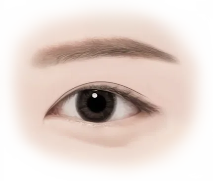 Нүдний дээд зовхины мэс заслын зураг, нүдний хэлбэрийг засах зорилготой гоо сайхны мэс засал.