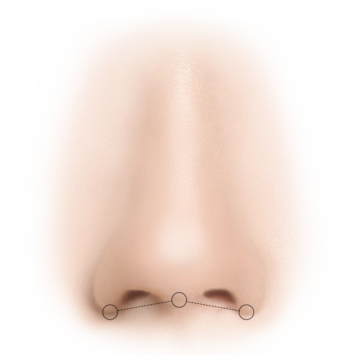 Хамрын үзүүрийг өргөх мэс заслын зургийг харуулсан бөгөөд хамрын доод хэсэгт гурван дугуйлан, тасархай шугамаар холбогдсон байна.