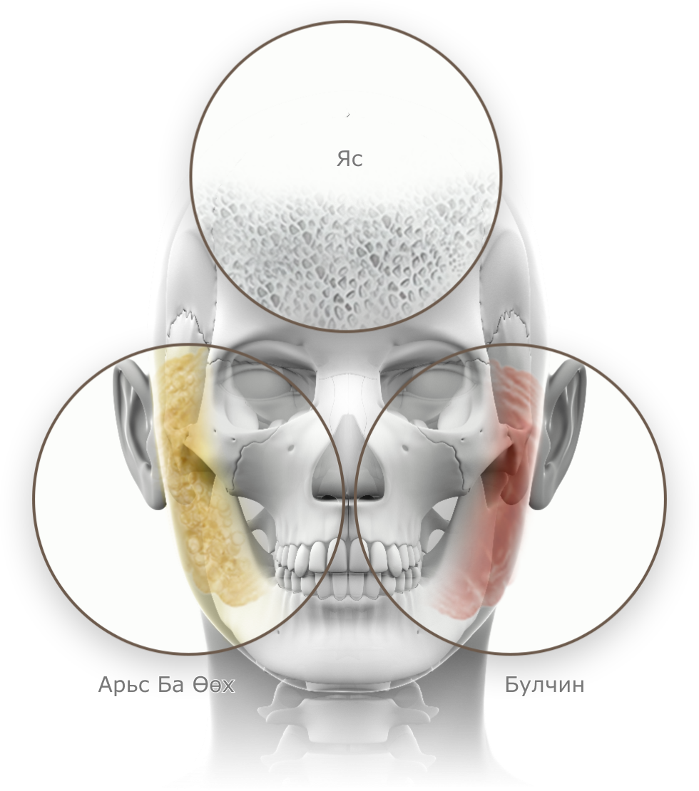 Нүүрний араг ясны зураг дээр яс, арьс ба өөх, булчинг тойрог хэлбэрээр харуулсан нь нүүрний контур, лифтинг мэс заслын анатомийн бүтэц юм.
