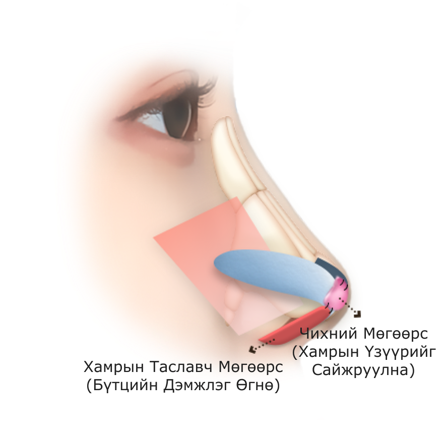 Хамрын мэс заслын график дүрслэл, хамар заслын үйл явцыг харуулсан зураг. Хамрын хэлбэр засах мэс заслын талаарх мэдээлэл.