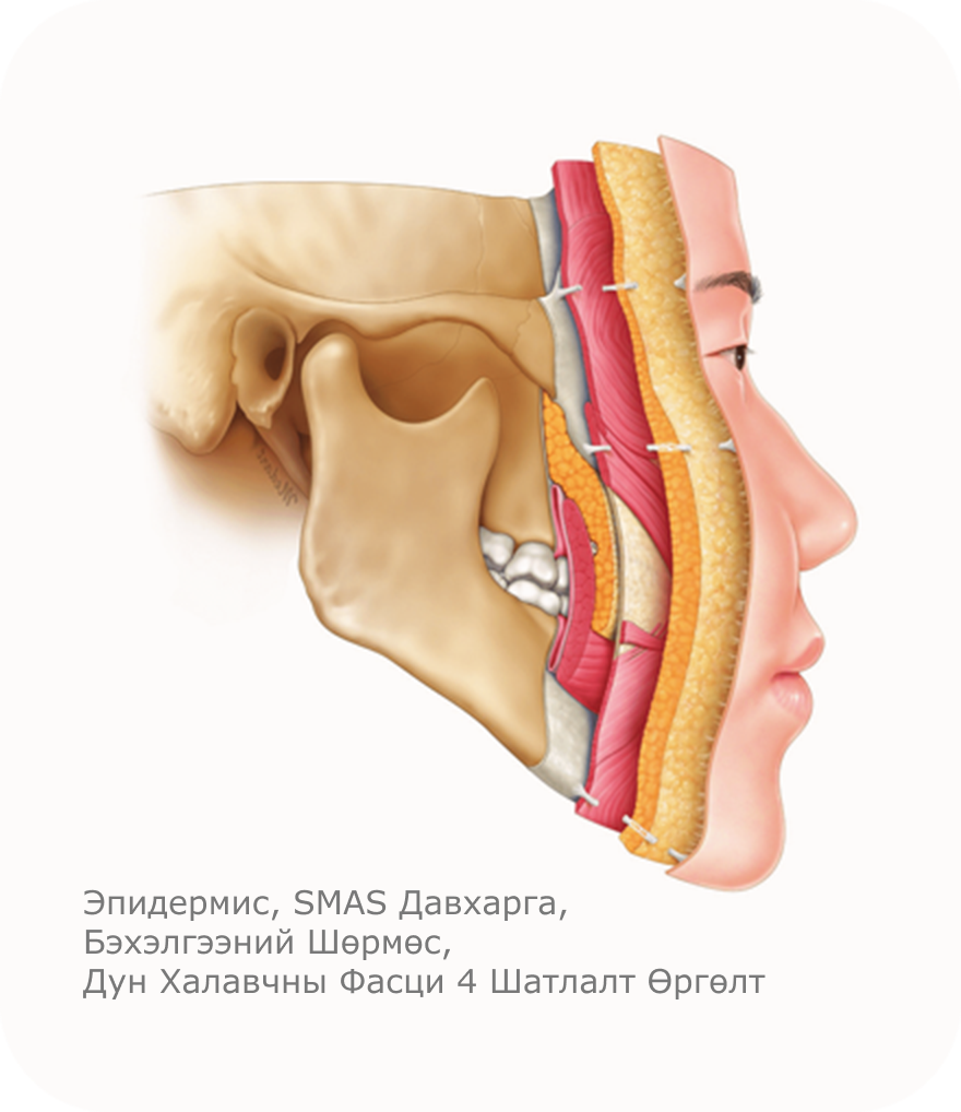Нүүрний анатомийн зурагт эпидермис, SMAS давхарга, бэхэлгээний шөрмөс, дун халавчны фасци 4 шатлалт өргөлтийг харуулсан дүрслэл.